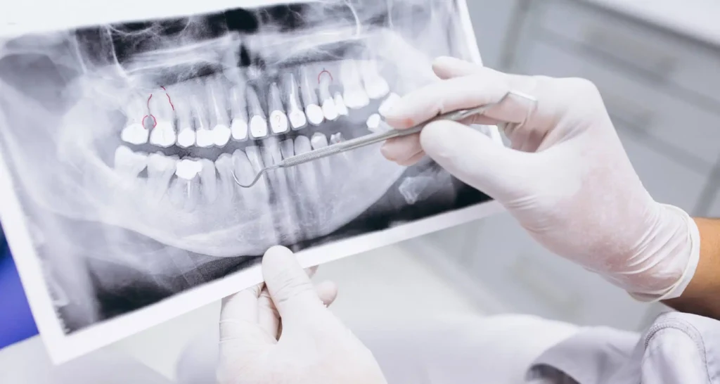 Cost of Studying Dentistry in Turkey