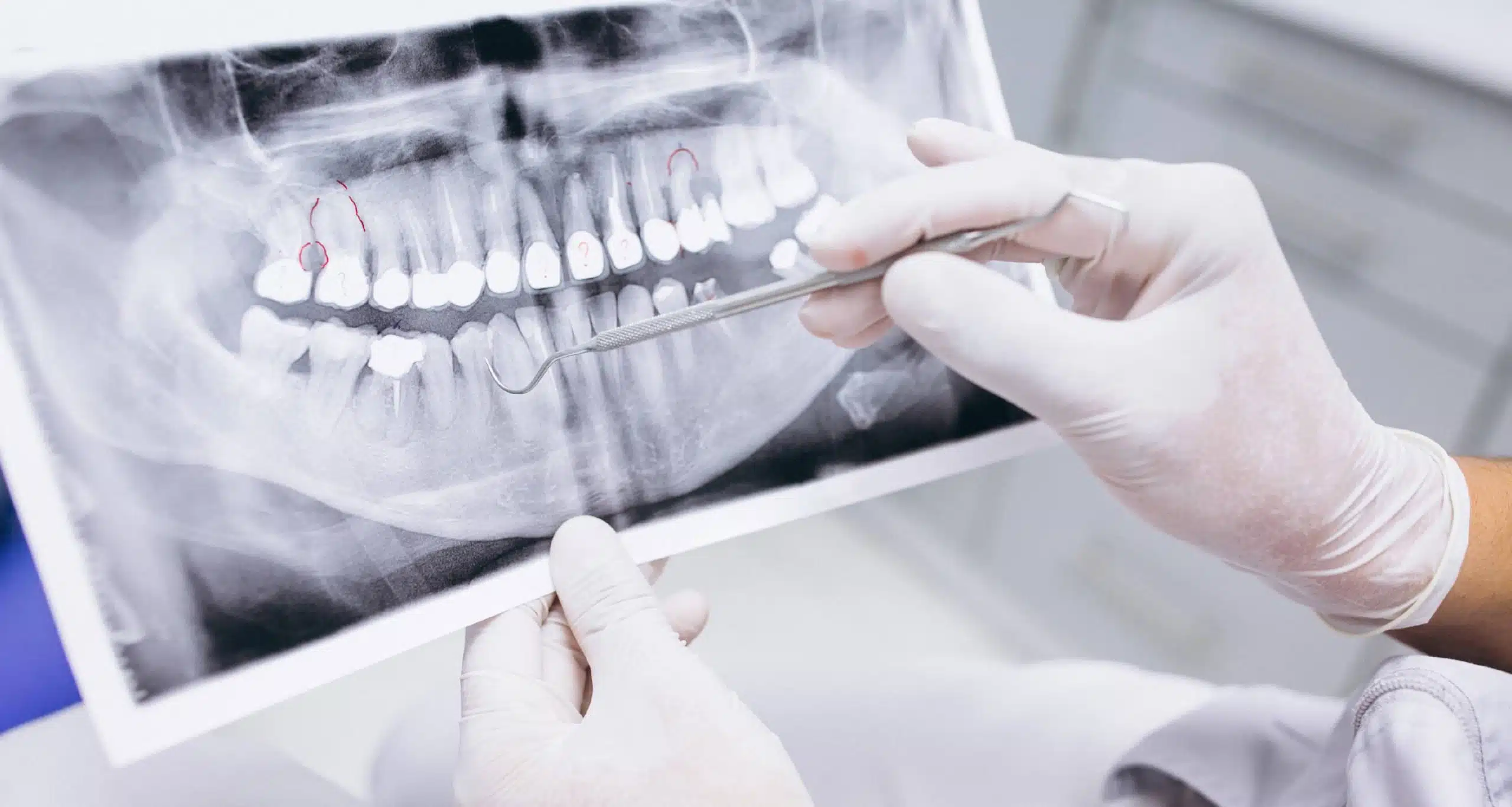 طب الأسنان
